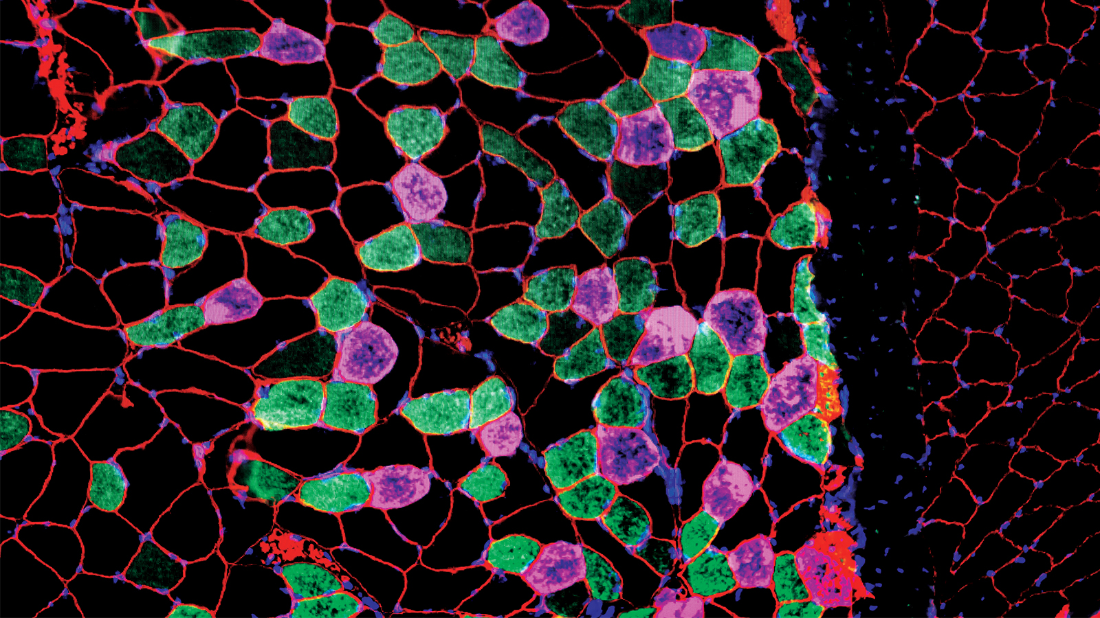 An image of muscle cells, an array of shapes, with green, purple, and red colors. 
