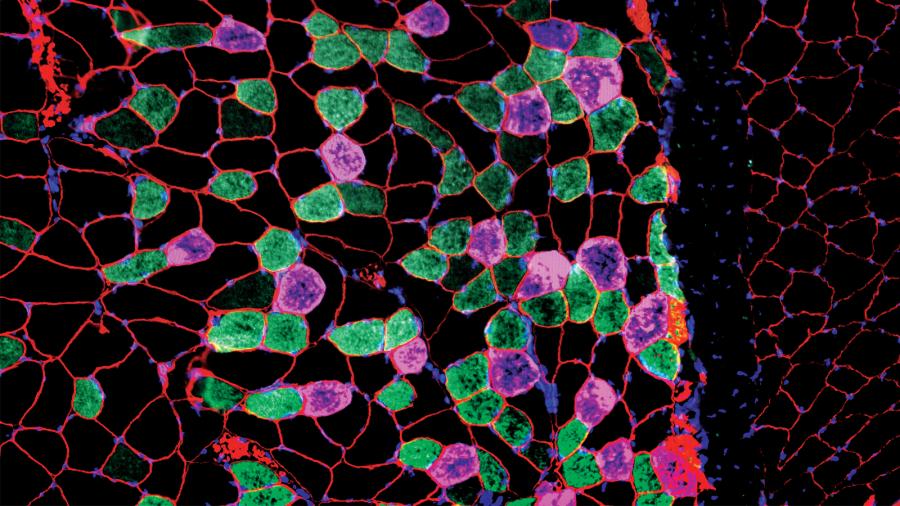 Muscle cells as seen under a microscope